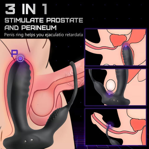 Anal tamponade vestibular vibrator prostate massager